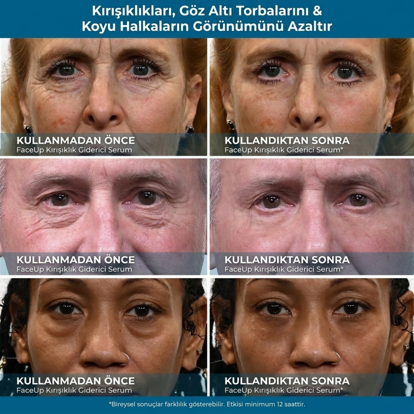 FaceUp Kore Formülü Gençlik Krem