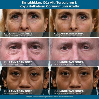 FaceUp Kore Formülü Gençlik Krem