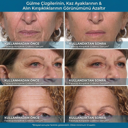 FaceUp Kore Formülü Gençlik Krem